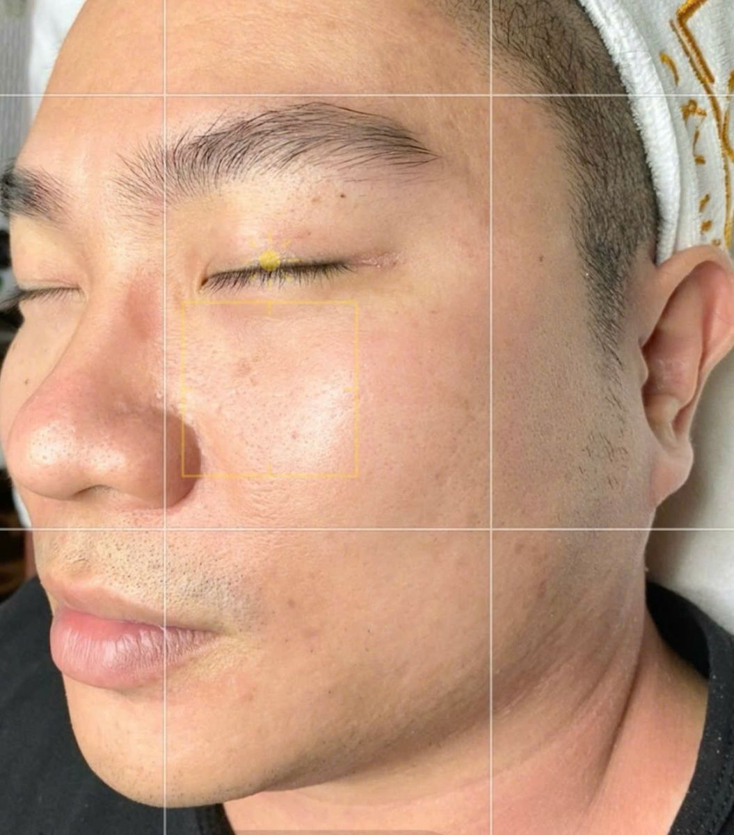 Chăm Sóc Da Mặt Cơ Bản